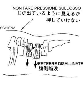 dolore lombare